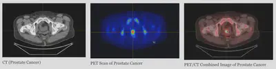Examples of scans